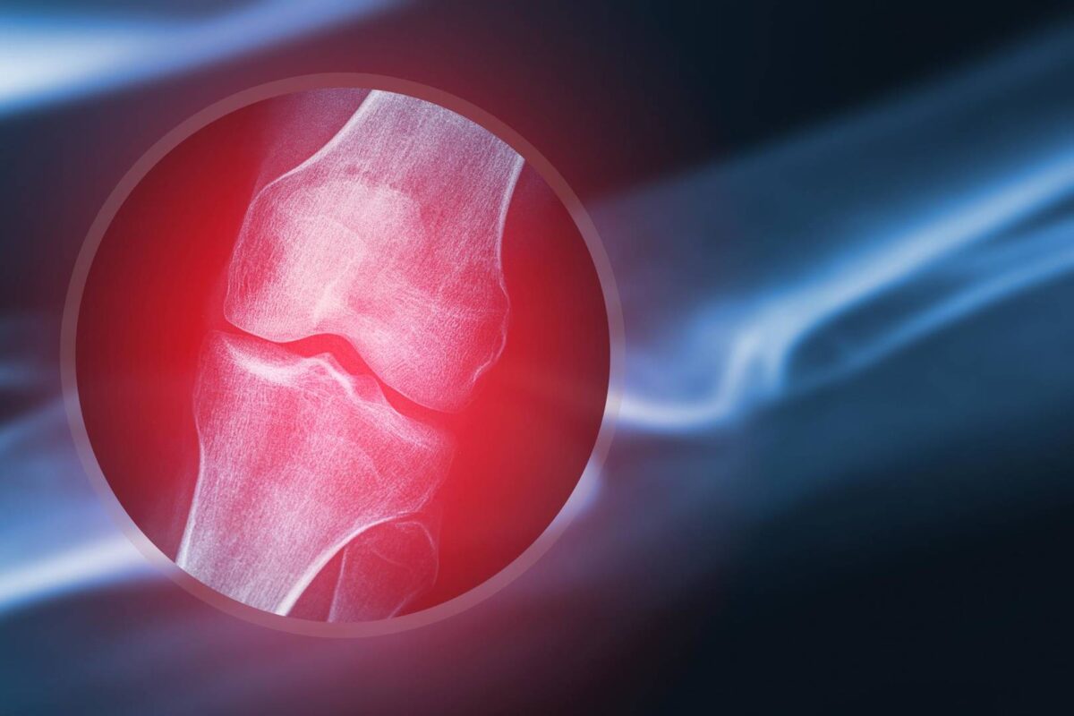 Common Joint Problems and How to Prevent Them - ScopeNew