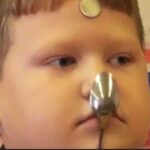 Spoonkid